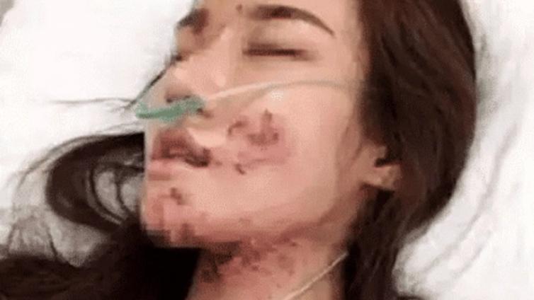 【最智慧家庭教育】熊孩子割断安全绳，害女孩毁容，谁来为 “他还是个孩子”买单？